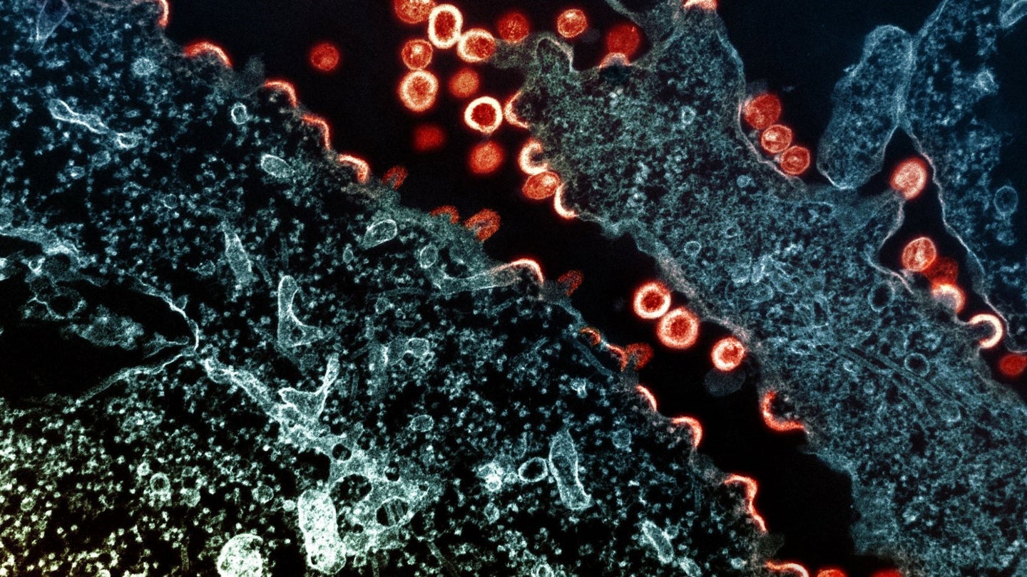 HIV, seen in red budding particles, is among the deadliest viruses.
